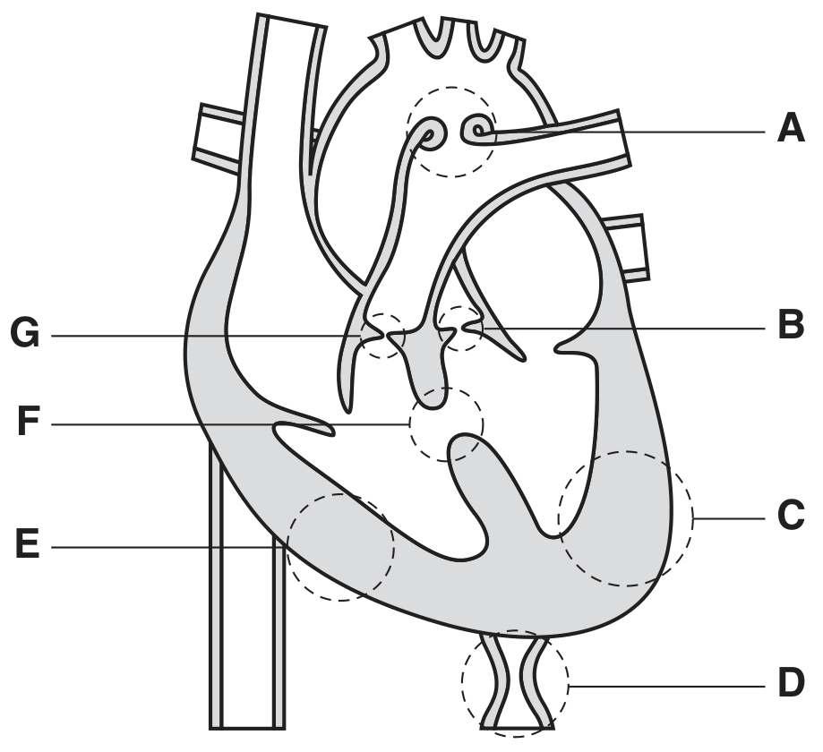Fig. 2.2