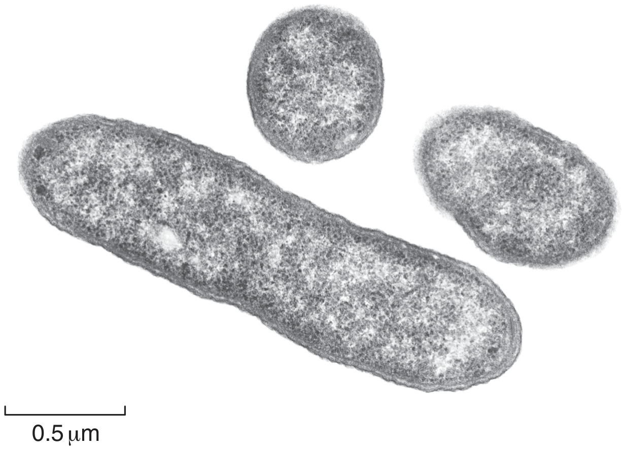 Fig. 1.1
