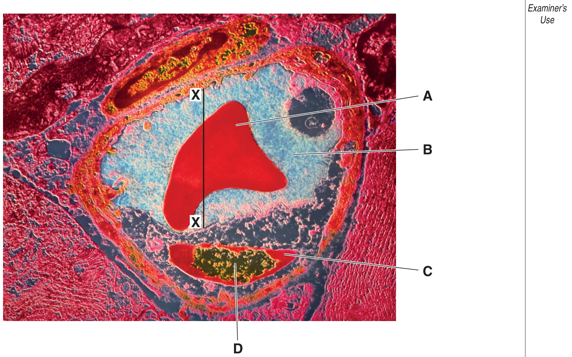 Fig. 1.1