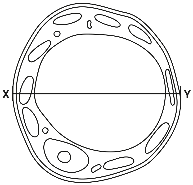 Fig. 1.1