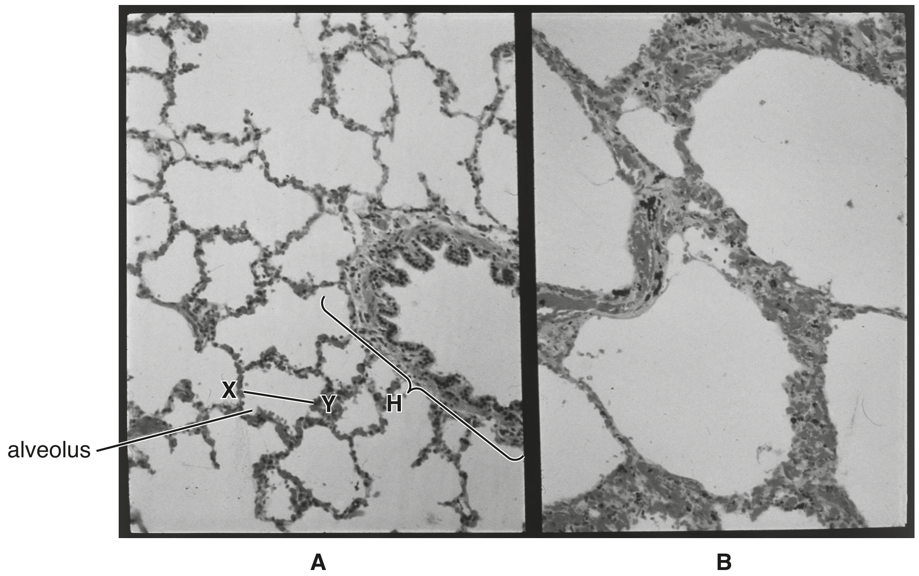 Fig. 1.1