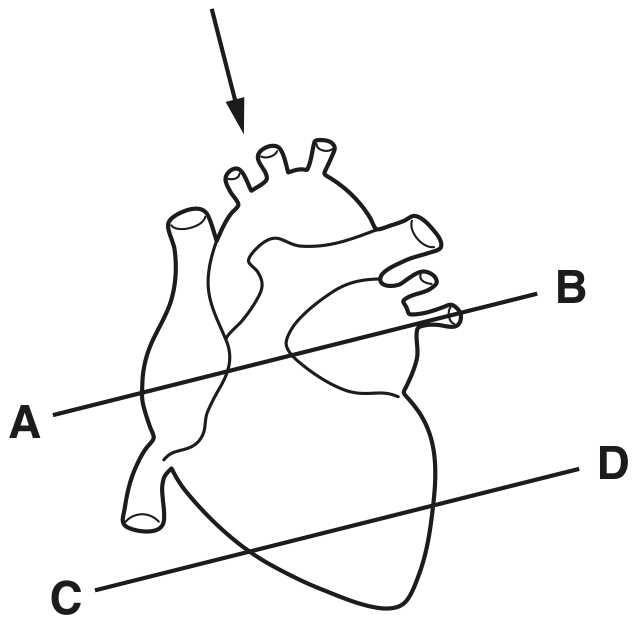 Fig. 5.1