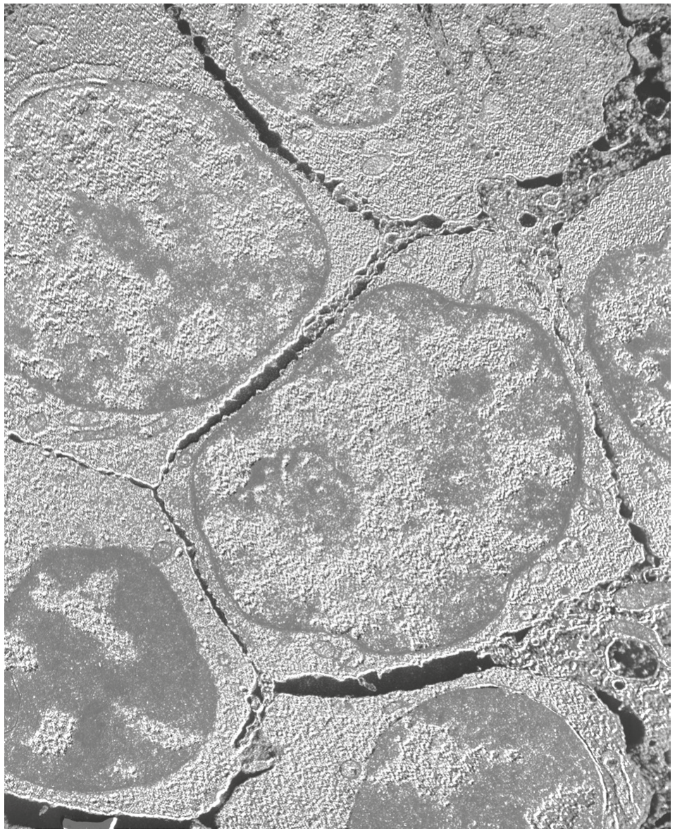 Fig. 3.1
