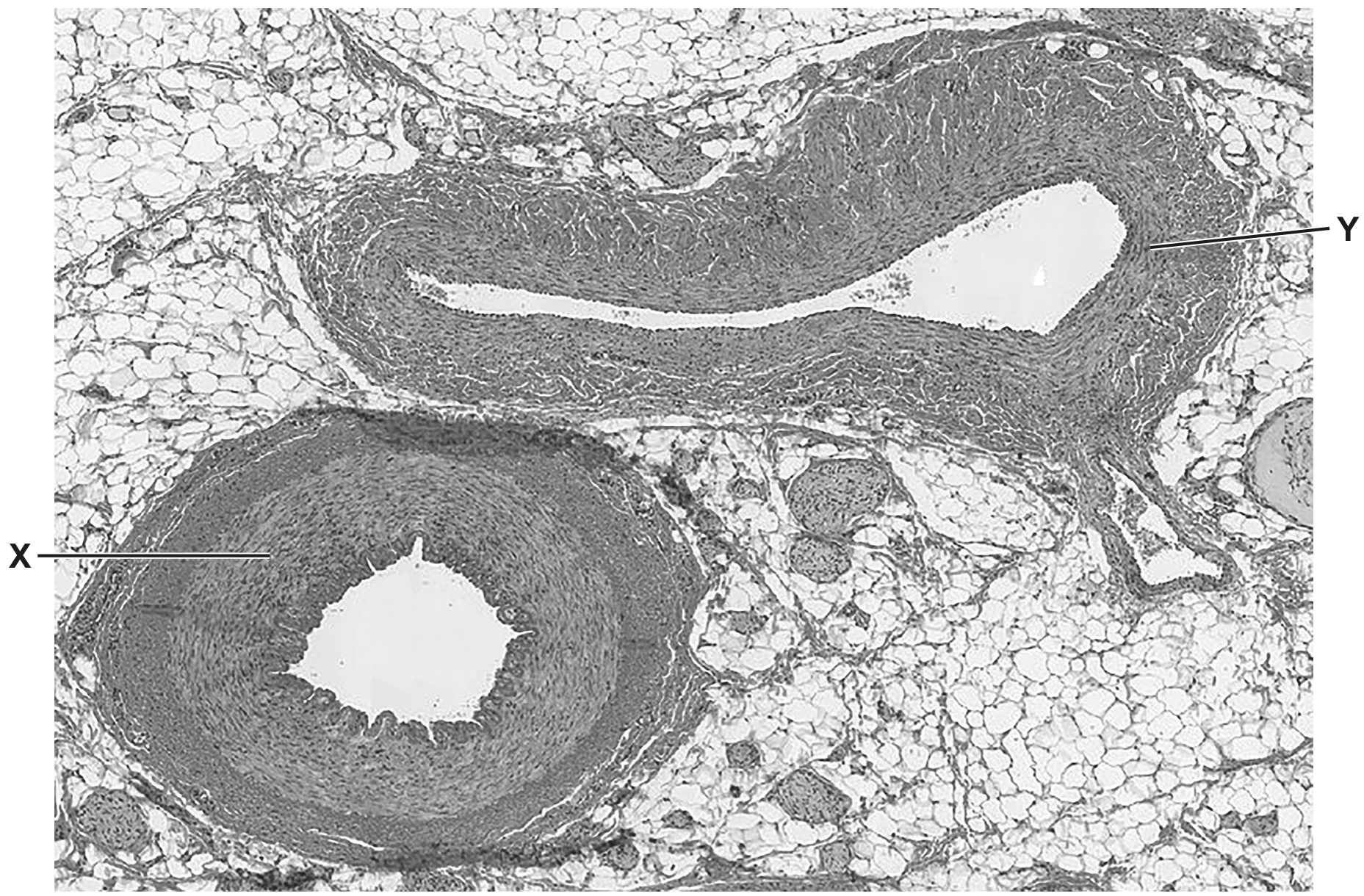 Fig. 3.1