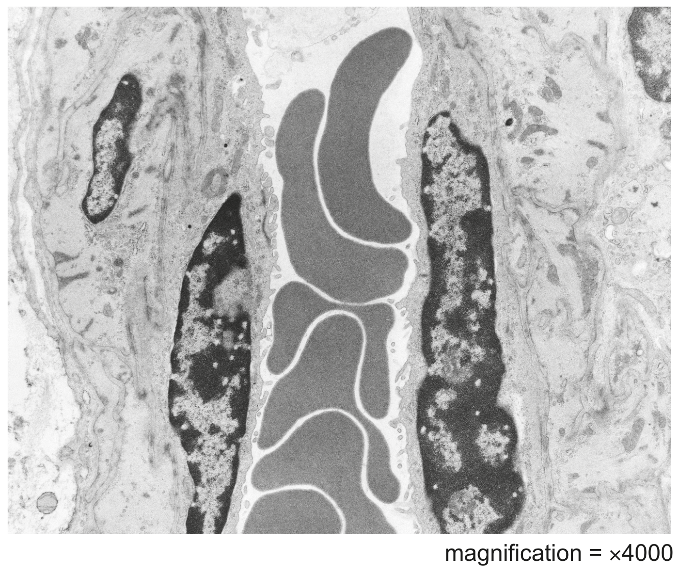 Fig. 3.1