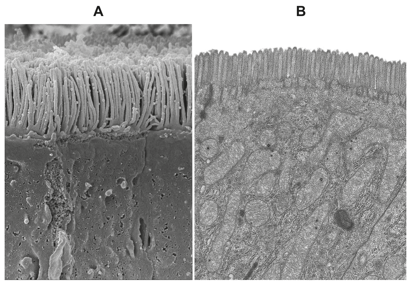 Fig. 1.1