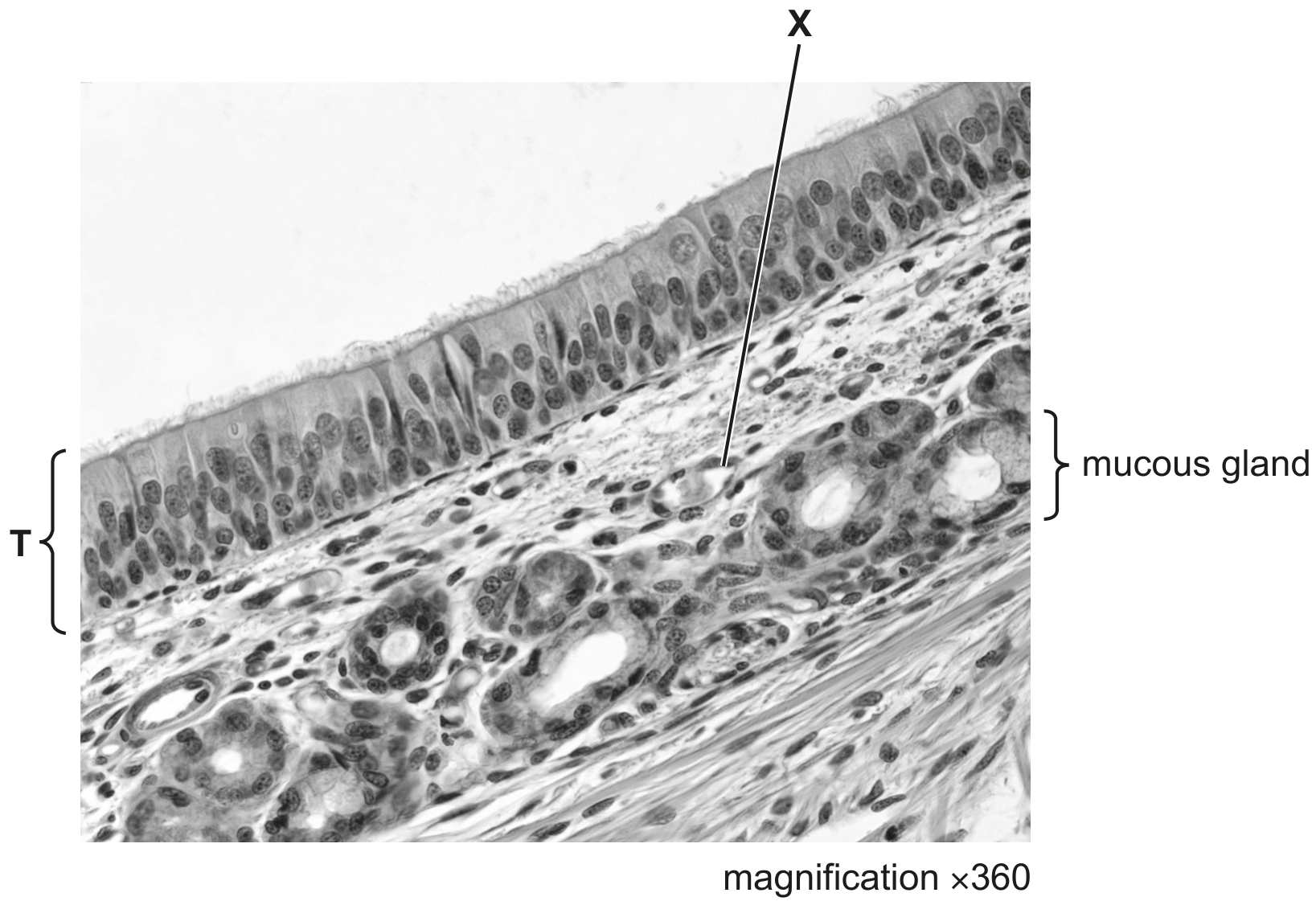 Fig. 1.1
