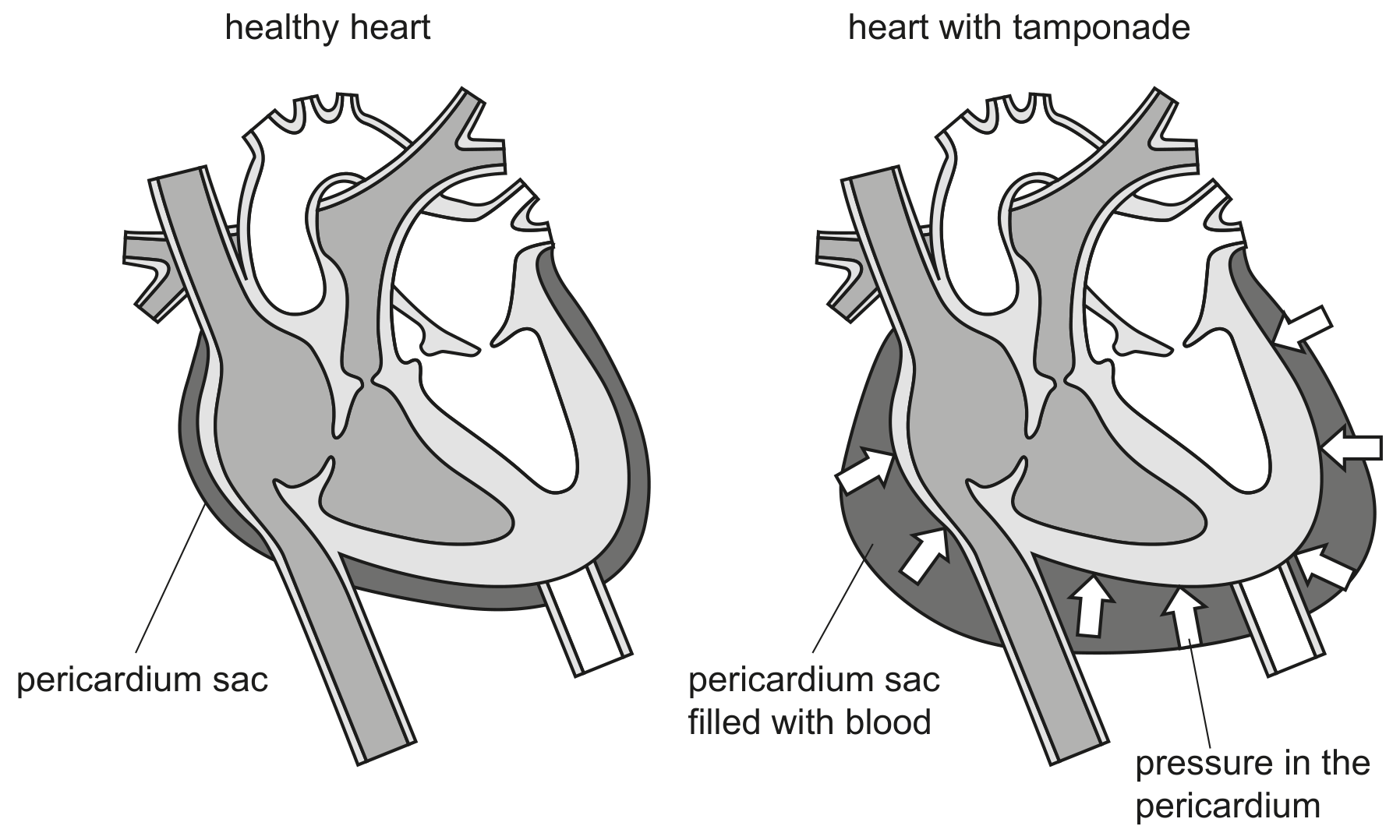Fig. 4.2