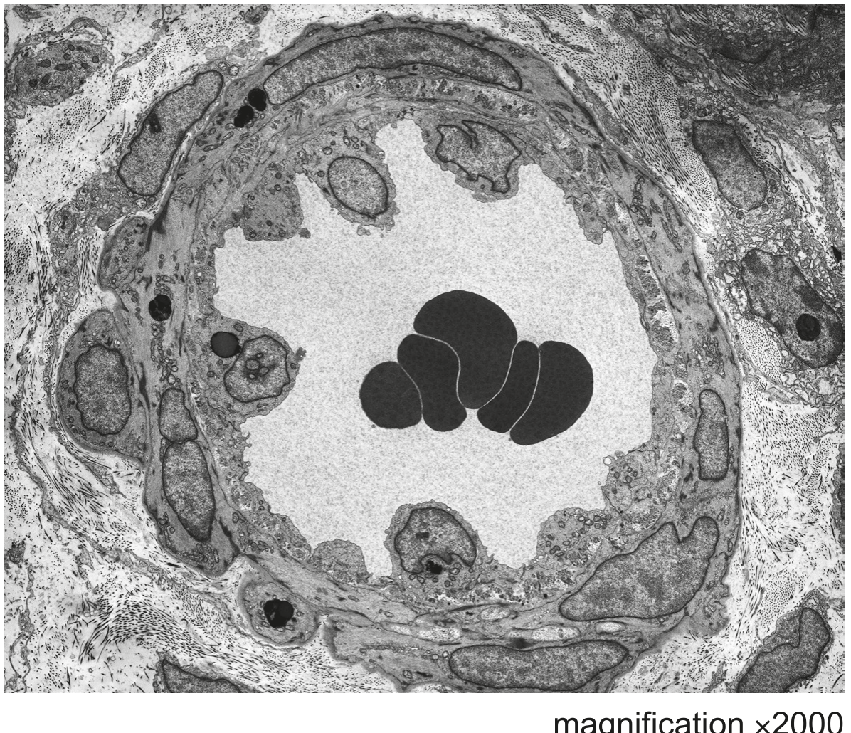 Fig. 2.2