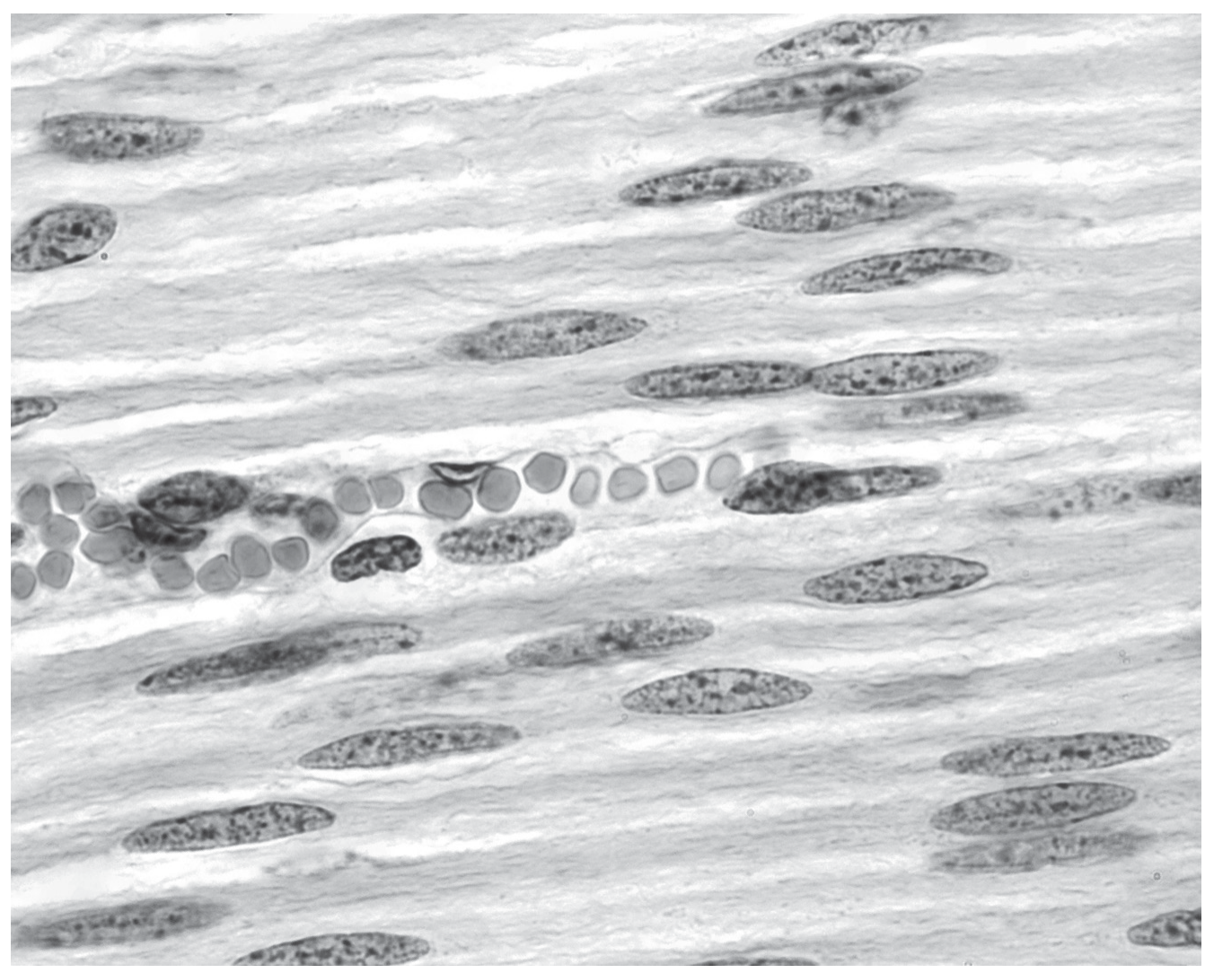 Fig. 1.2